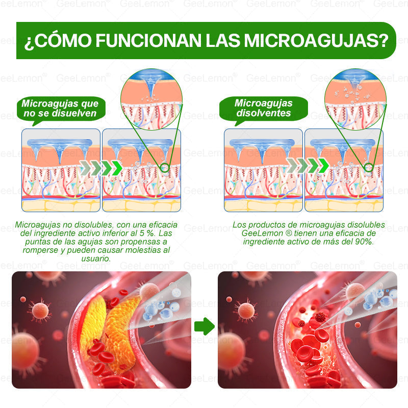 𝐆𝐞𝐞𝐋𝐞𝐦𝐨𝐧® Parche de Microagujas Nano Avanzado 10 en 1 con Moringa, Berberina y NAD+(𝐒𝐨𝐥𝐨 𝐮𝐧𝐚 𝐯𝐞𝐳 𝐚𝐥 𝐝í𝐚, 𝐜𝐚𝐦𝐛𝐢𝐨𝐬 𝐯𝐢𝐬𝐢𝐛𝐥𝐞𝐬 𝐞𝐧 𝟕 𝐝í𝐚𝐬)🎉 𝐏𝐚𝐫𝐚 𝐨𝐛𝐞𝐬𝐢𝐝𝐚𝐝, 𝐏𝐈𝐄𝐋 𝐅𝐋𝐎́𝐂𝐈𝐃𝐀, 𝐝𝐢𝐚𝐛𝐞𝐭𝐞𝐬, 𝐚𝐩𝐧𝐞𝐚 𝐝𝐞𝐥 𝐬𝐮𝐞ñ𝐨, 𝐩𝐫𝐨𝐛𝐥𝐞𝐦𝐚𝐬 𝐚𝐫𝐭𝐢𝐜𝐮𝐥𝐚𝐫𝐞𝐬 𝐲 𝐦á𝐬
