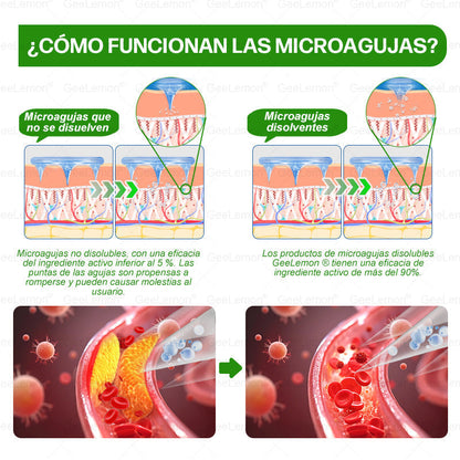 𝐆𝐞𝐞𝐋𝐞𝐦𝐨𝐧® Parche de Microagujas Nano Avanzado 10 en 1 con Moringa, Berberina y NAD+(𝐒𝐨𝐥𝐨 𝐮𝐧𝐚 𝐯𝐞𝐳 𝐚𝐥 𝐝í𝐚, 𝐜𝐚𝐦𝐛𝐢𝐨𝐬 𝐯𝐢𝐬𝐢𝐛𝐥𝐞𝐬 𝐞𝐧 𝟕 𝐝í𝐚𝐬)🎉 𝐏𝐚𝐫𝐚 𝐨𝐛𝐞𝐬𝐢𝐝𝐚𝐝, 𝐏𝐈𝐄𝐋 𝐅𝐋𝐎́𝐂𝐈𝐃𝐀, 𝐝𝐢𝐚𝐛𝐞𝐭𝐞𝐬, 𝐚𝐩𝐧𝐞𝐚 𝐝𝐞𝐥 𝐬𝐮𝐞ñ𝐨, 𝐩𝐫𝐨𝐛𝐥𝐞𝐦𝐚𝐬 𝐚𝐫𝐭𝐢𝐜𝐮𝐥𝐚𝐫𝐞𝐬 𝐲 𝐦á𝐬