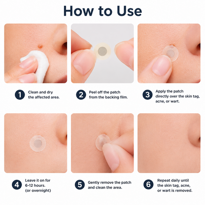 Hiskin ® 2-in-1 Microneedle & Hydrocolloid Patch🍀 | Removes raised moles, acne, flat warts, and skin tags | Helps improve wrinkles, scars, and blemishes | Invisible patches for face and body