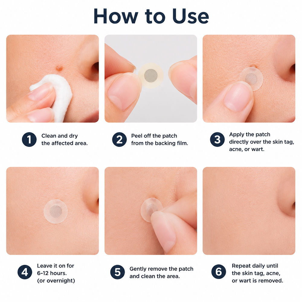 Hiskin ® 2-in-1 Microneedle & Hydrocolloid Patch🍀 | Removes raised moles, acne, flat warts, and skin tags | Helps improve wrinkles, scars, and blemishes | Invisible patches for face and body