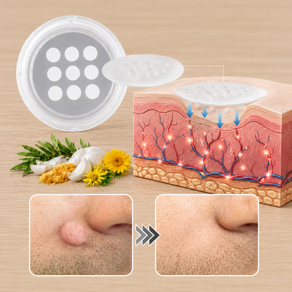 Hiskin ® 2-in-1 Microneedle & Hydrocolloid Patch🍀 | Removes raised moles, acne, flat warts, and skin tags | Helps improve wrinkles, scars, and blemishes | Invisible patches for face and body