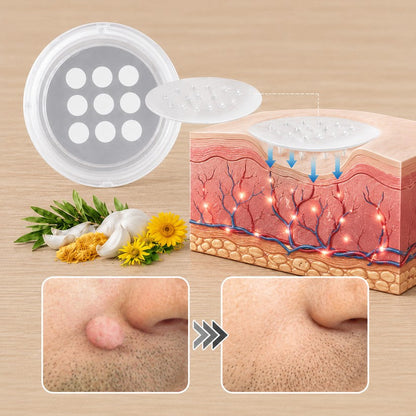 Pureshade® 2-in-1 Microneedle & Hydrocolloid Patch ✨Invisible Face & Body Patches for Raised Moles, Acne, Flat Warts & Skin Tags - Helps Improve the Appearance of Wrinkles, Scars & Blemishes